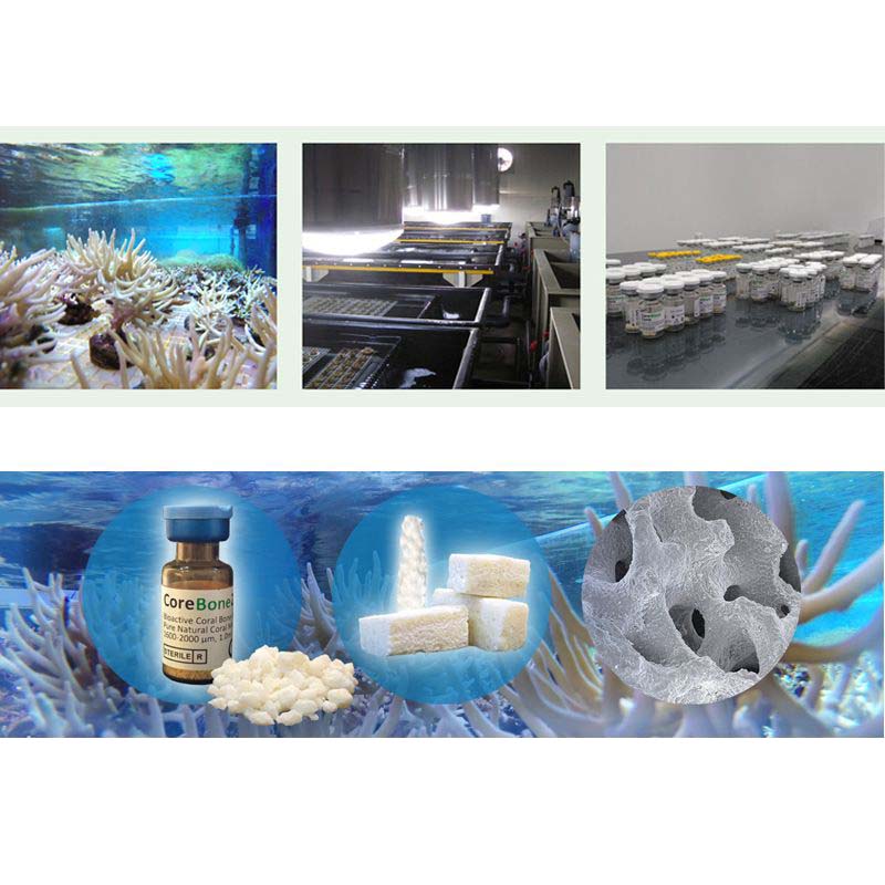 Bio coral bone graft material for dental implant - different views