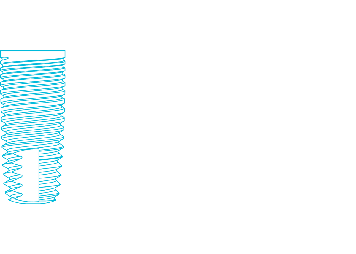 U-Razor® Cylindrical Implant – Dental Pro™